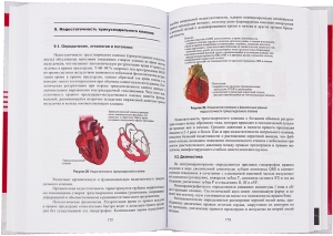 Болезни сердечно-сосудистой системы в практике врача-терапевта