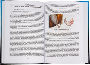 Гнойная хирургия детского возраста