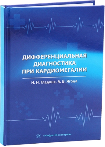 Дифференциальная диагностика при кардиомегалии