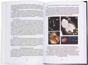 Поражение сердечно-сосудистой системы при ревматических заболеваниях
